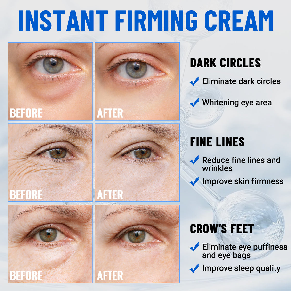 iMethod Perfection Eye Tightener - Temporary Eye Tightener Cream, Under Eye Cream, Instant Firming Formula for Fine Lines & Wrinkles, 20ml